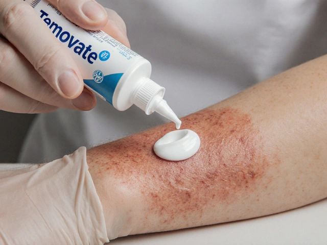 Temovate (Clobetasol) vs. Topical Steroid Alternatives: Full Comparison Guide